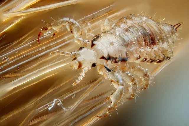 Piojo de cabeza (Pediculus humanus capitis) macho vista lateral